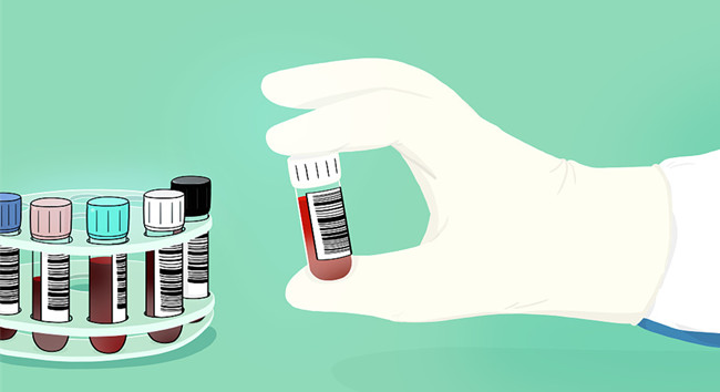 進(jìn)口胎牛血清關(guān)需要什么資質(zhì)？